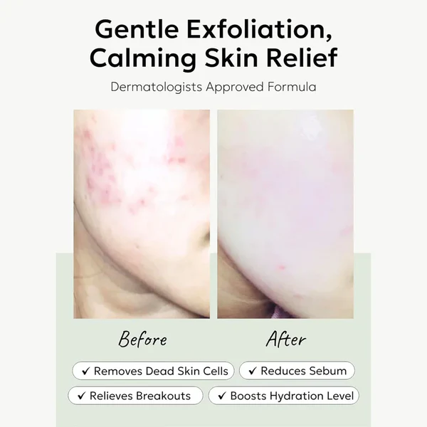 Celimax Ji.Woo.Gae Heartleaf BHA Peeling Pad 60 τεμ. - Image 2