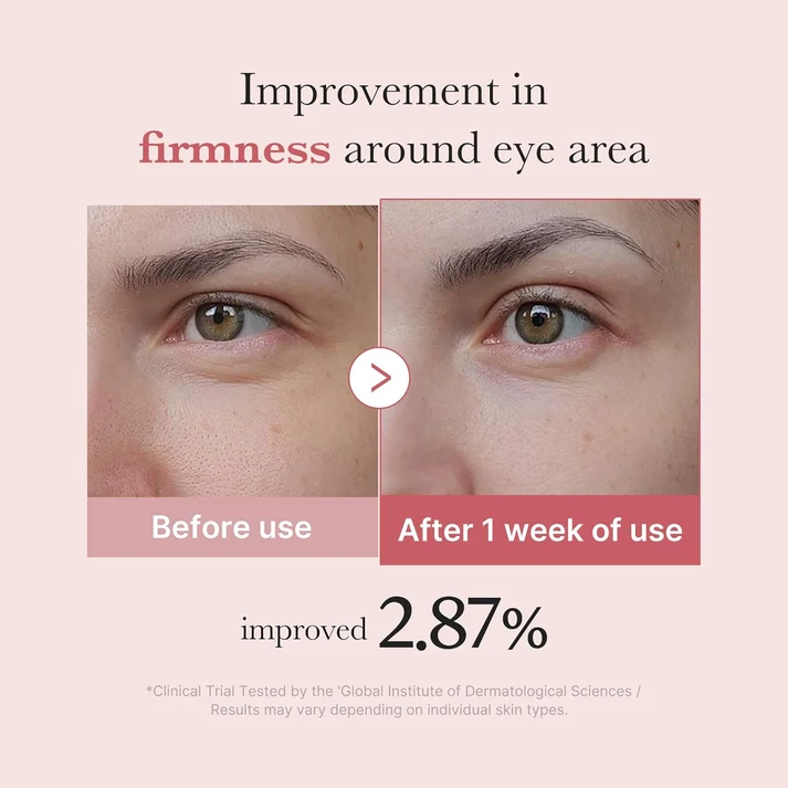 Medicube PDRN Pink Peptide Eye Cream - Κρέμα ματιών για ρυτίδες και μαύρους κύκλους - Image 3